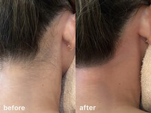 リコ ヘアアンドリラクゼーション(LICO)/うなじワックス