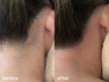 リコ ヘアアンドリラクゼーション(LICO)/うなじワックス