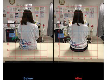 ストレチックス 近江八幡店/姿勢改善ビフォーアフター1回