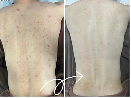 エミルカ 神戸三宮(EMILUCA)の写真