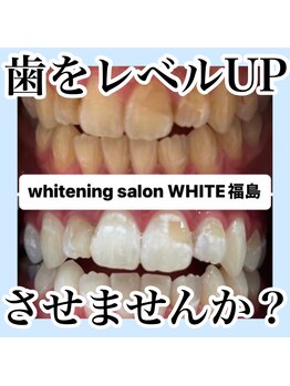 ホワイトニングサロン ホワイト(WHITE)/歯をレベルUPさせませんか？