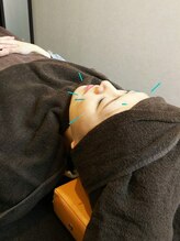 ノゾミ(Nozomi)/美容鍼