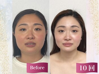 キュット(Qtto)/お顔を美しく若見えせることが