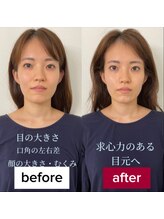 サロンチオリ 烏丸(Salon Chiori)/《30代》小顔矯正