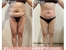 ヴィクシア(VIXIA)の雰囲気（圧倒的変化なら当店へ/50代ビフォーアフター）