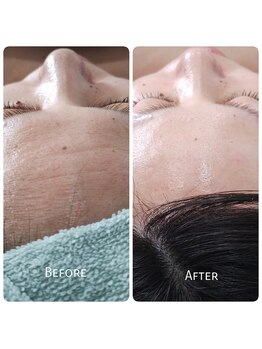 オリス(ORRIS)/V3針でハリを♪