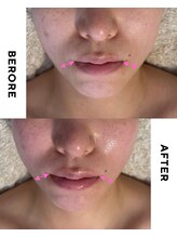 ビューティーセイバー 馬車道(BEAUTY SAVIOR) 韓国で人気 オンダ
