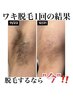 【ご新規様】Mパーツ ¥3000→¥2500 