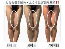 痩身革命 大宮店/最短で痩せたいあなたへ♪