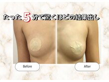 ルミエール(Lumiere)/たった5分で驚くほどの結果出し
