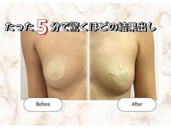 ルミエール(Lumiere)/たった5分で驚くほどの結果出し