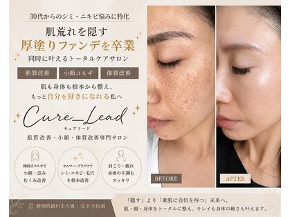 キュアリード(Cure_Lead)の写真