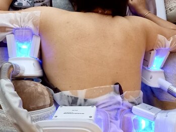 スタートフィットネス プラス エステ/脂肪冷却 二の腕施術風景