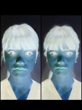 みのお骨盤リフォーム整骨院/小顔矯正　before after