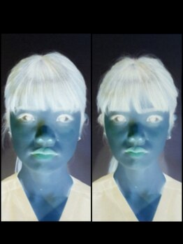 みのお骨盤リフォーム整骨院/小顔矯正　before after