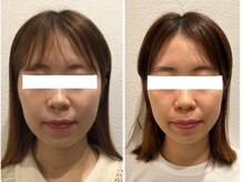 ウェリナ平和堂長久手院/小顔矯正/骨盤矯正/痩身/整体