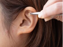 ジラソル(girasol)/耳つぼ施術