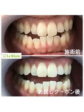 ルブラン 奈良店(Le Blanc)/確実な効果でます！