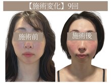 ドクターボディ 恵比寿店(Dr.Body)/【顔の歪み&左右差　30代】