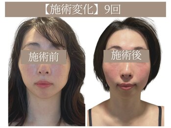 ドクターボディ 恵比寿店(Dr.Body)/【顔の歪み&左右差 30代】