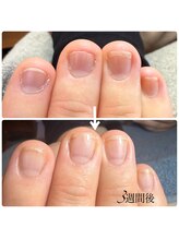 ミリアネイル 成城(Miliea nail)/