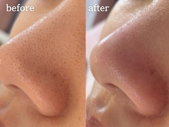 メルシア(merucia)/