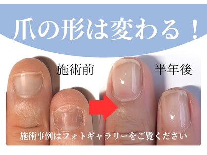 リング ザ ベル(ring the bell)の写真