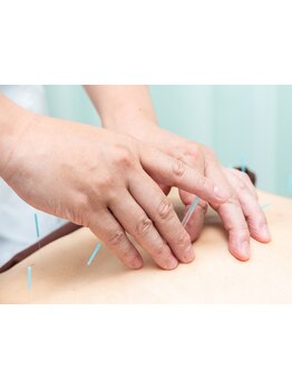 鍼灸施術を受けたい