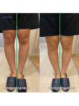 グレフル鍼灸接骨院 整体院 心斎橋/整体/肩こり/マッサージ/腰痛