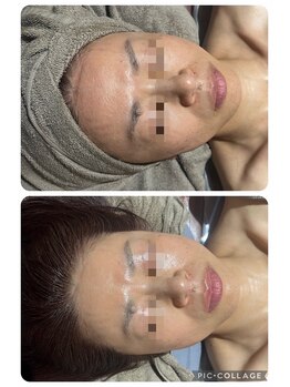 リボーン(be reborn)/肌を育てる喜び