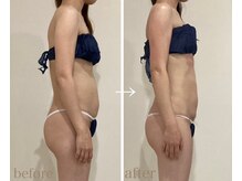 ハクカスパ(HAKUKA SPA)/