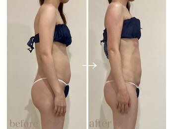 ハクカスパ(HAKUKA SPA)/