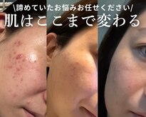 エステティックサロン ナチュラーレ