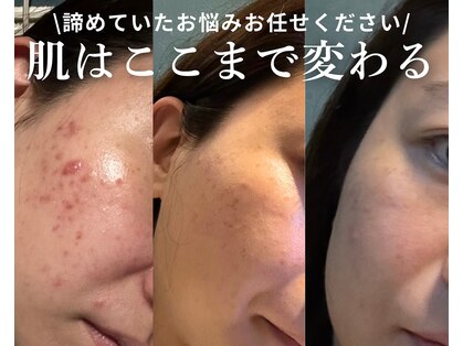 エステティックサロン ナチュラーレの写真