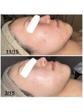 ミニョン(mignon)/モニター結果！