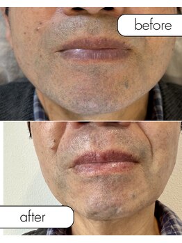 トッコ 清澄白河店(tocco)/朝のヒゲそり面倒ですよね