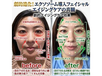 アロハカウア(Aloha Kaua)の写真