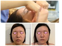 ボタニカル小顔整体(botanical小顔整体)の雰囲気（モニター様効果写真　メニュー『小顔整顔&姿勢矯正』）