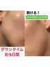 【即効性】REVI剥けるハ-ブピ-リングダウンタイムあり肌質改善¥22700