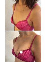 カナエルサロン 旭川(KANAERU SALON)/【バストアップ】症例☆