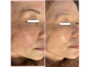 メリー 大和八木店(merry)/年齢を感じさせないふっくらお肌