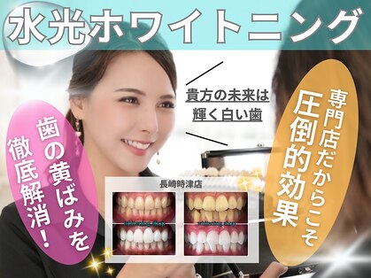 ホワイトニングショップ 長崎時津店の写真