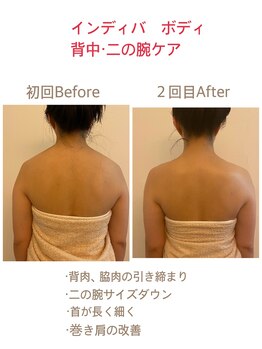 クレール(clair)/「インディバボディ」施術前後
