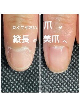 シッカネイル(sicca nail)/丸くて小さい爪も