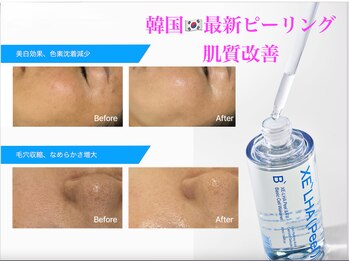 アイデザインエルソル(Eye Design el Sol)の写真/【新生活応援】この春は新しい自分へ♪皮剥けやダウンタイムなし!速攻ツヤツヤ美肌GET♪敏感肌の方も◎