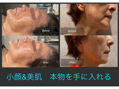 ココル(COCORU)の写真