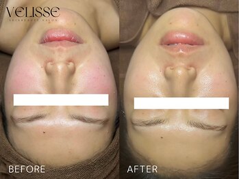 ヴェリス 福岡店(Velisse)/