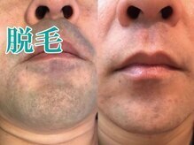 レディース ビホウ(BIHOU)/