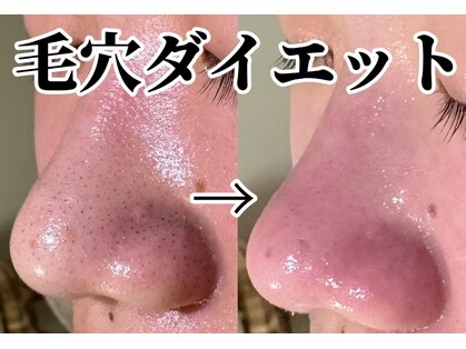 チル(Chill)の写真