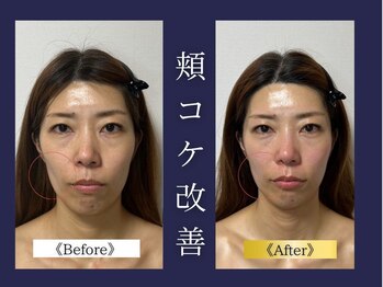 エレミュー 烏丸(Elemue.)/長年のコンプレックスも大丈夫